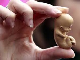 Азербайджан находится на втором месте в мире в рейтинге проблем селективного аборта